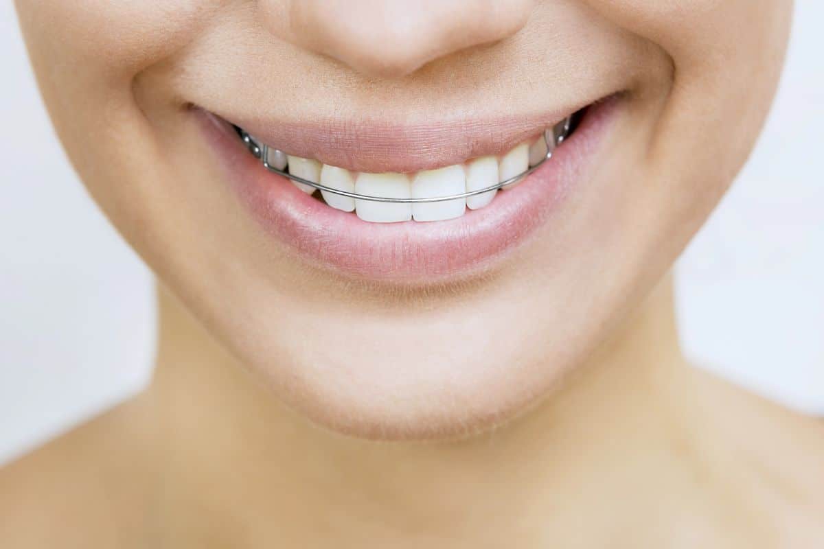 A woman smiles with a retainer on her teeth.